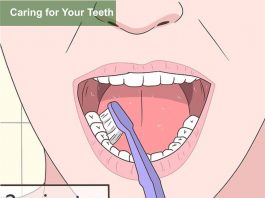 Caring for Your Teeth