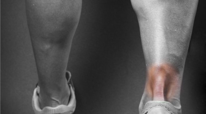 How to prevent Achilles tendinitis