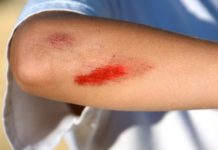 Cuts & Scrapes: First Aid